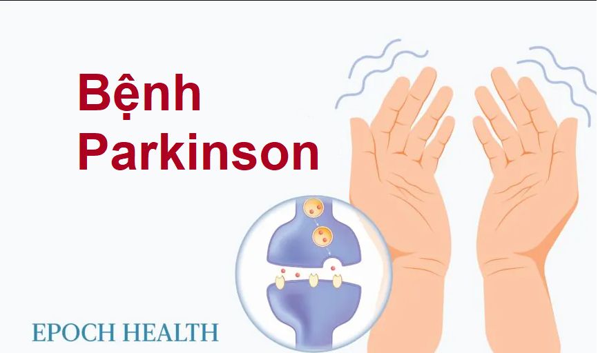 Hướng dẫn cần thiết về bệnh Parkinson: Triệu chứng, nguyên nhân, phương pháp điều trị và liệu pháp tự nhiên